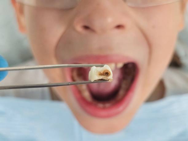 Best Pediatric Emergency Dentist in Marco Island, FL